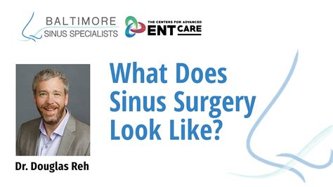 What Does Sinus Surgery Look Like? - Towson, Maryland - ENT Surgery