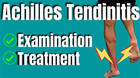 Achilles Tendinitis Treatment | San Diego Sports Therapy - YouTube