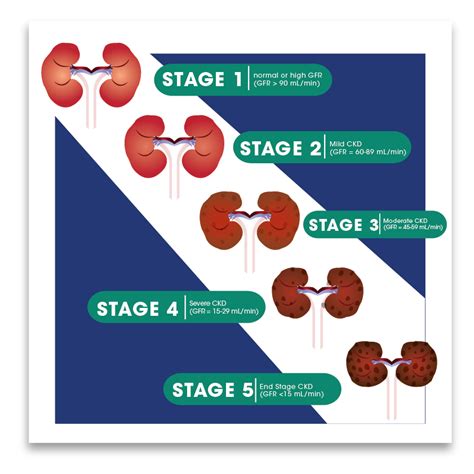 CHRONIC KIDNEY DISEASE (CKD)