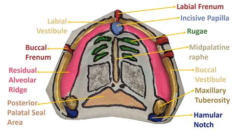 ANATOMICAL LANDMARKS OF MAXILLARY ARCH | MAXILLA | PROSTHODONTICS | DENTAL OCCLUSION - YouTube