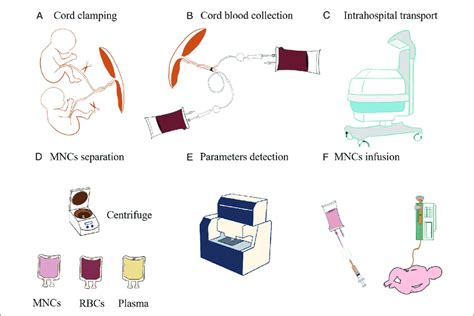 Cord blood processing flow diagram. (A) Cord clamping. (B) Cord blood ...