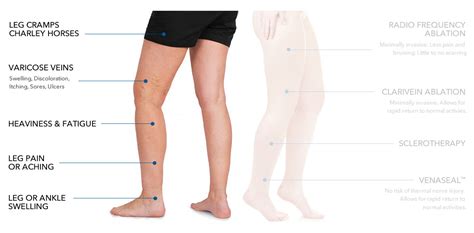 Las Vegas Vein Doctor - Alpha Vein Clinic - Dr. Sassan Kaveh