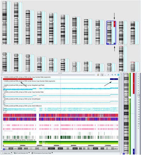 The SNP array detection results of in the fetus. The arrows indicated... | Download Scientific ...