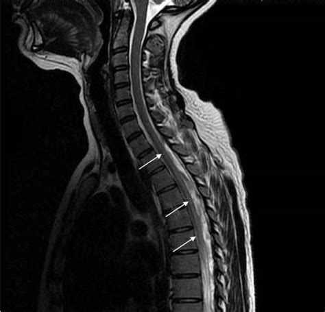 What Does Magnetic Resonance Imaging (MRI) Show? - IYTmed.com