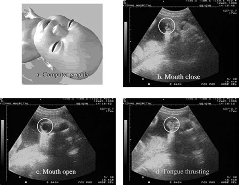 types of fetal presentation ultrasound