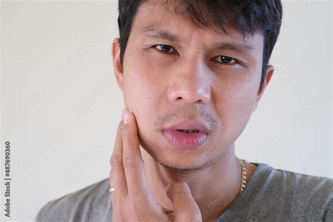 Teetch problem. Asian male with painful cheek swelling or dental ...