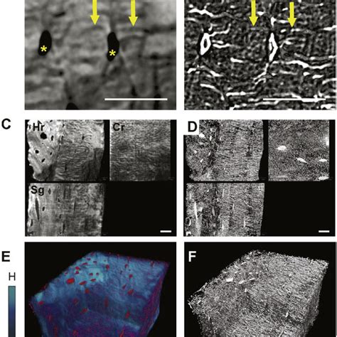 The lacuno-canalicular-bone canal network. Osteocyte canaliculi are... | Download Scientific Diagram