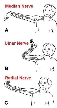 10 Radial Nerve Glides ideas | radial nerve, hand therapy, nerve