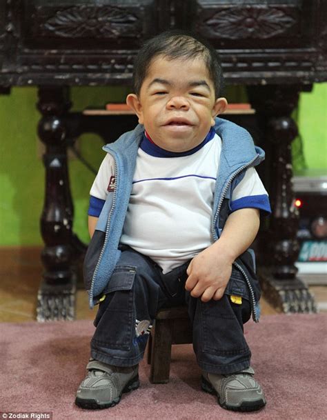 Edward Hernandez from Colombia says being the world's smallest man is a dream come true | Daily ...