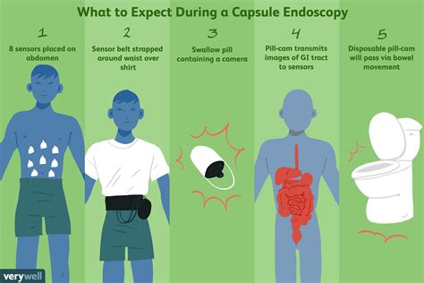 Capsule Endoscopy Uses, Side Effects, and Results