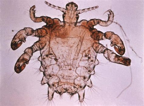 Pubic Lice (Crabs) Facts on Transmission, Life Span, Infestation | Healthhype.com