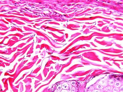 Dense Irregular Connective Tissue | histologyolm.stevegallik.org