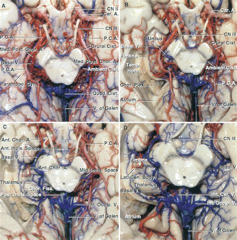 Tentorial Incisura | Neuroanatomy | The Neurosurgical Atlas