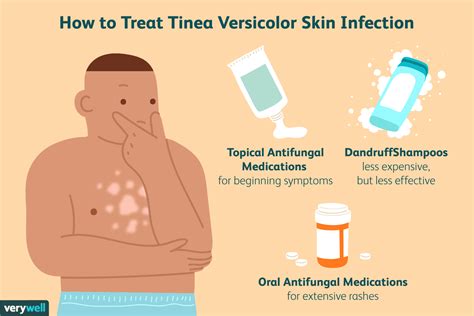 Tinea Versicolor Treatments: What's Most Effective?