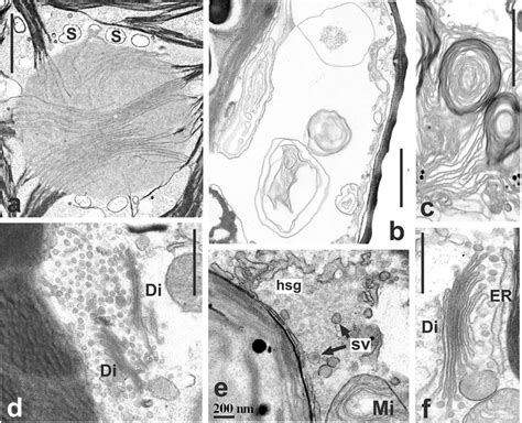 a-f Ultrastructural changes in the Cosmarium strains treated at 35 °C... | Download Scientific ...