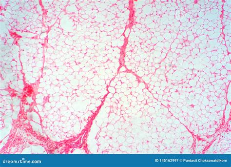 Human Fat Body Tissue Under Microscope View Stock Image - Image of abdomen, cellulite: 145162997