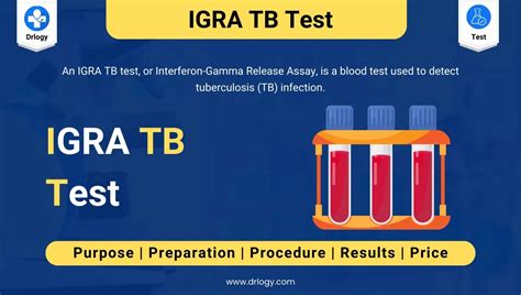 IGRA TB Test: Price, Purpose, Normal Range and Results - Drlogy