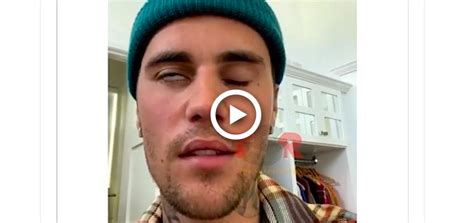 Justin Bieber Face Paralyzed video instagram - TheCount.com