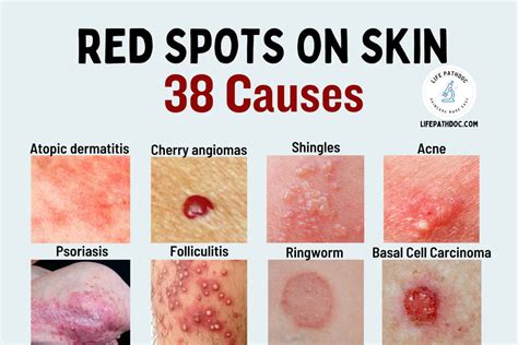 What Are These Tiny Red Spots On My Skin Causes Remed - vrogue.co