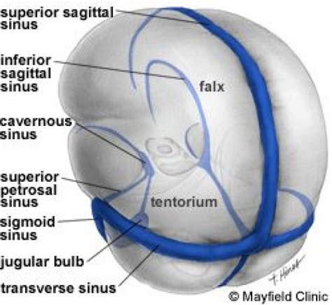 Illustration the two major dural folds the falx and tentorium along with the venous sinuses. # ...