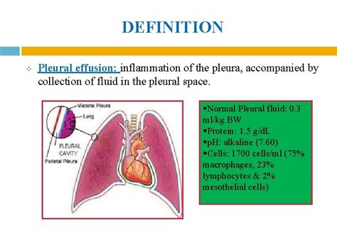 Loculated Pleural Effusion Meaning - Pneumonia And Pleural Effusion ...