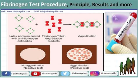 Fibrinogen Test Procedure, Principle, Results and more | Lab Tests Guide