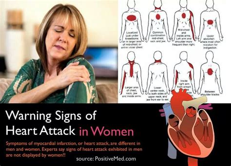 Signs For Heart Attack In Woman at Ana Lewis blog