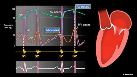 Mayo Clinic Minute: What Heart Sounds Tell Us - Mayo Clinic News Network