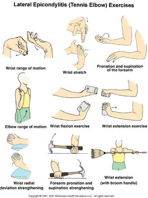 Tendonitis (tennis) elbow exercises and stretches | Elbow exercises, Tennis elbow, Tennis elbow ...