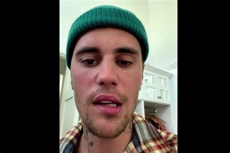 Justin Bieber souffre d’une paralysie au visage, annule plusieurs dates de tournée | La Presse