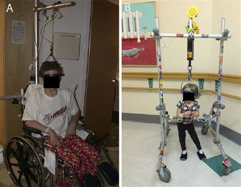 A Wheelchair halo-gravity traction apparatus. Fig. 4B Walker ...