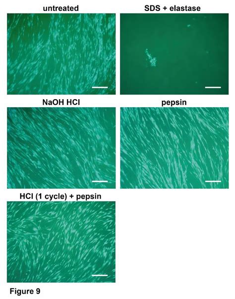 Calcein AM staining of ASCs seeded on cartilage, untreated and treated... | Download Scientific ...