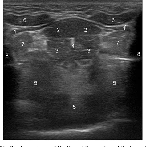 Neck Muscles Ultrasound