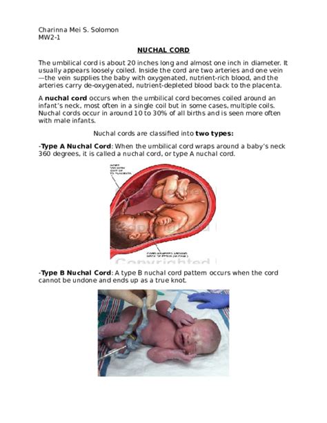 (DOC) NUCHAL-CORD | Charinna Mei - Academia.edu