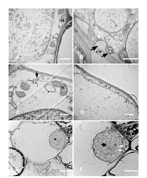 Cell ultrastructure of aerenchyma formation in Nelumbo nucifera roots ...