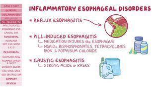 Schatzki Ring: What Is It, Causes, Treatment, and More | Osmosis