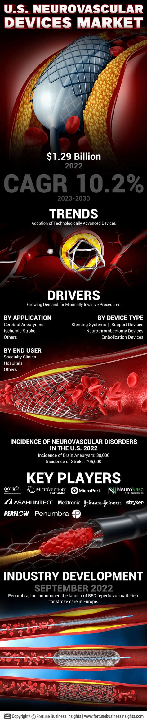 Infographics - U.S. Neurovascular Devices Market