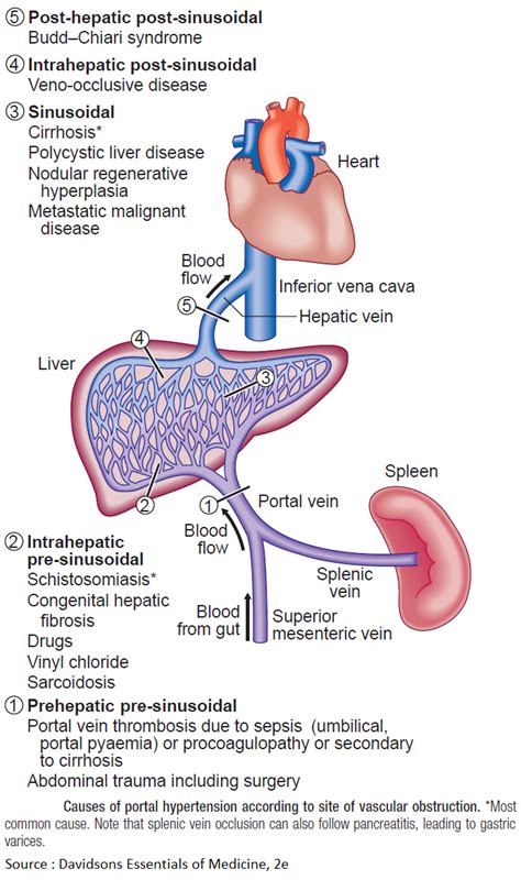 Causes Of Young Hypertension - Hypertension - NASM - Check spelling or ...