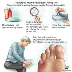 36 Foot Injury Prevention ideas in 2021 | foot injury, injury ...