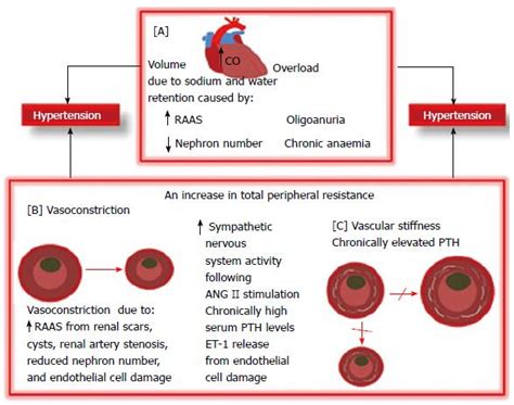 Pre-treatment considerations in childhood hypertension due to chronic ...