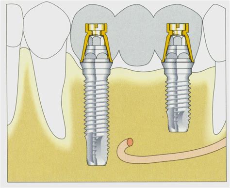 blog de odontologia | Informe-se sobre planos de tratamento em ...