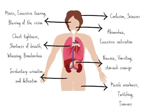 Feeling Nervous? Recognition and Management of Nerve Agent Exposure EMRA