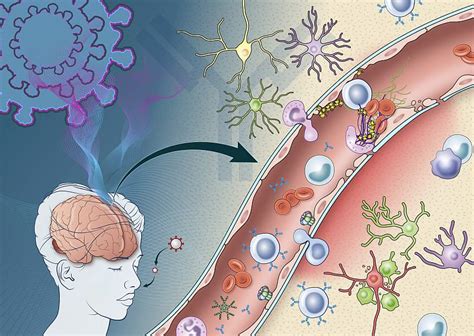 Small NIH study reveals how immune response triggered by COVID-19 may ...