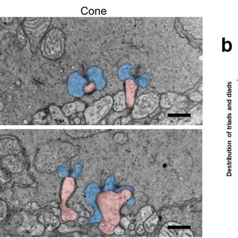 The mapped CSNB interval and the genetic variant in LRIT3 leading to a ...