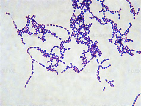 Science Source - Streptococcus Pyogenes