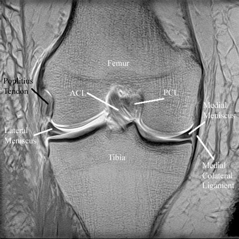 Magnetic Resonance Imaging (MRI) - Specialist Knee Surgeon in Manchester | Professor Sanjiv Jari