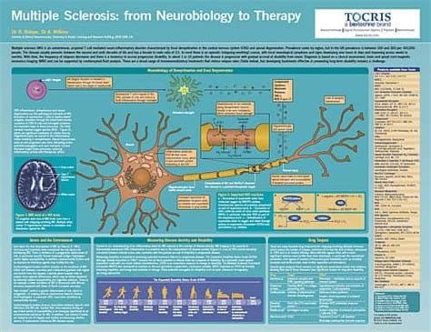 Multiple Sclerosis Life Science Poster | Tocris Bioscience