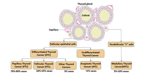 About Thyroid Tumor, This Information You Must Know! - Cusabio