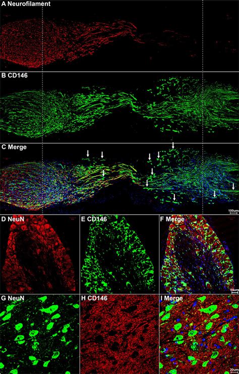 Frontiers | Up-Regulation of CD146 in Schwann Cells Following Peripheral Nerve Injury Modulates ...