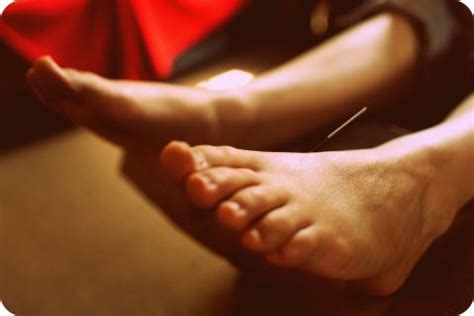 Acupuncture Foot Needle | whereapy